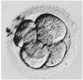 A multicelled human embryo, 2½ days after its removal from a womb. It was cryogenically stored at the Bourn Hall Fertility Clinic, Cambridgeshire, England.