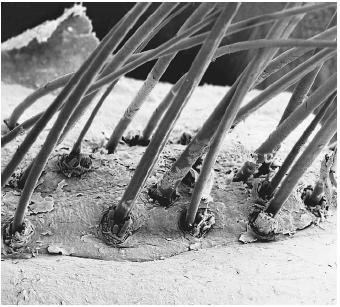 A scanning electron micrograph of eyelashes growing from the surface of human skin.