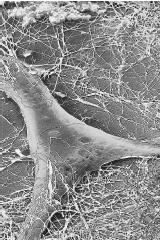 A scanning electronic micrograph of a fibroblast and collages fibers. Collagen is a major component of connective tissue.